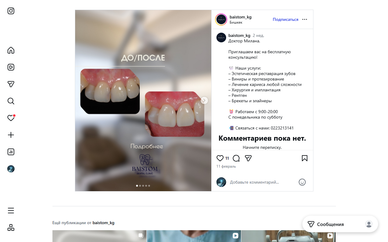 Эстетическая реставрация зубов