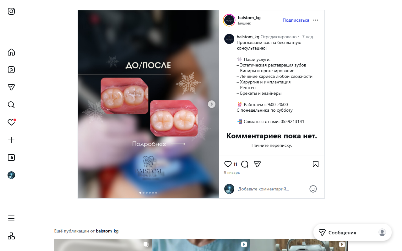 Коронки и вкладки