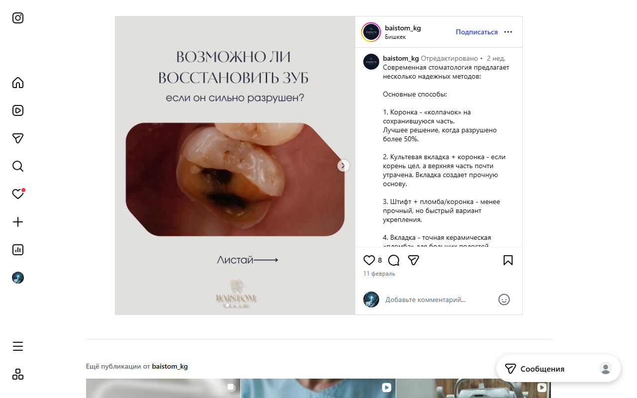 Виниры и протезирование